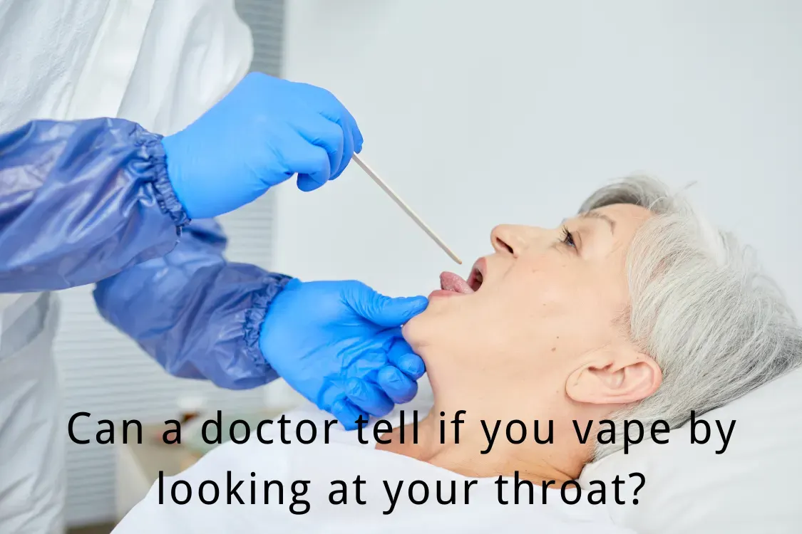 Can a doctor tell if you vape by looking at your throat?